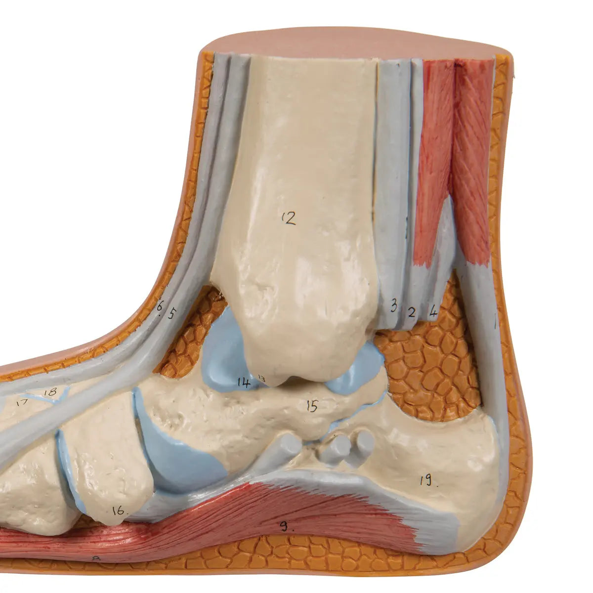 Squelette d'un pied plat (Pes Planus) - My Podologie